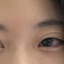 강남성모원안과의원 이미지