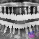 서울배치과의원 이미지