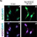 녹차 속 성분이 알츠하이머 막는다?…美 연구진 ‘뇌 청소 기능’ 회복 확인 이미지