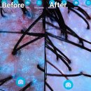 화봉정비 | 울산 두피 관리 두피디톡스 후기 : 올가드림뷰티 화봉점