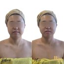 해반천로 | 김해 삼계 비율랩에스테틱 윤곽 피부관리 내돈내산 후기
