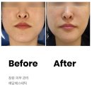 예담이네 | 창원피부관리 예담에스테틱 용호동 수분 윤곽관리 후기