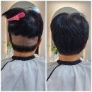 부산남자붙임머리 자극없이 모모즈헤어 증모&amp;붙임머리