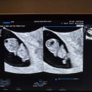 연세365산부인과의원 이미지