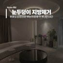 차에 진심인 남자 | 남자 눈두덩이지방제거 + 눈매교정 레오성형외과 노협찬 찐 후기!