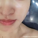 세종 필 무인텔A | 세종피부관리 셀앤수 세종보람점 필링재생관리