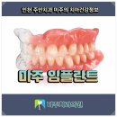 명성치과기공소 이미지