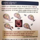 강블맥 | 1. 27주 밑빠짐통증이 자궁경부무력증? 더블맥수술 산본제일병원 맥도날드수술 후기