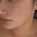 세븐일레븐 송도드림점 | [인천/송도] 피부 톤이 한층 밝아진 &#39;올가드림뷰티 송도점&#39; 재방문 후기