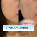 티아라피부관리실 | 대치동 윤곽관리전문 에스테티아 대치 1호점에서 예신관리 받고왔어요!