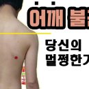 멸치탈출연구소 이미지