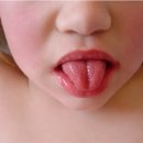 “목 아프고 혀에 하얀 백태”…그냥 넘겼다 폐렴 위험까지, ‘이 병’ 국내서도 유행? 이미지