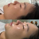 강남 피부관리, 에스텔뷰티에서 &#39;라인뷰&#39; 피부진단 받고 왔어요.