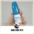 에스케이행복약국 | 지독한 비염 치료 후기!! [광고 X, 수술 X, 내돈내산]