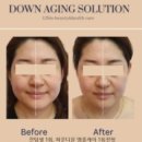 다운에이징자연성형연구소