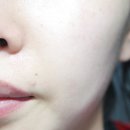 미백피부샵 이미지