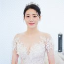 은혜헤어라인 이미지