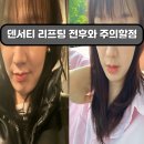 고주파 덴서티 리프팅 주의사항-압구정피부과 후기