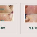 황금마사지 피부관리 이미지