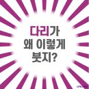 JS케어 이미지