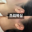 수유왁싱 | 더 깔끔해진 구레나룻 왁싱 후기 (1:1 맞춤 왁싱샵 쓰리왁싱)