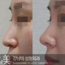 강남미의원 이미지