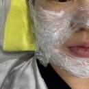 해운대 웨이브 | [해운대센텀 리프팅] 인모드 + 엑셀웨이브 후기