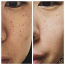 클로로필 효능 시너지 트루그린으로 만성염증, 혈액청소, 내돈내산 후기