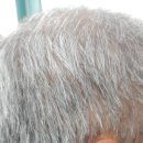 스타키보청기 청주육거리센터 이미지