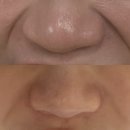 쁘띠댕댕 | 부산 해운대에서 쥬베룩볼륨 맞고왔어요. 중안부 관리로 동안얼굴만들기