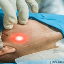 광光 치료 - 허와 실 이미지