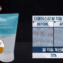 겟스마일 네이버블로그