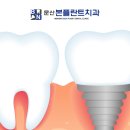 문산본플란트치과의원