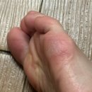 패디히얼