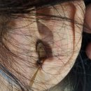 금강보청기 수성센터 이미지