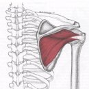 * 근막통 증후군 (극상근. 극하근) 이미지