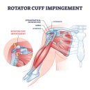 아이엠독 이미지