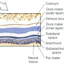Re: 뇌척수액의 생성, 뇌척수막의 구조 이미지