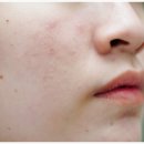 플로레스피부과의원 이미지