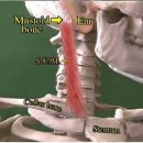 정형외과 - 사경[斜頸, torticollis] 이미지