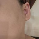 온포레