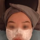 신사한의원 - 은평구 은평터널로 128-2 | 여드름 패인흉터 치료로 모공새살부스터 맞아보고 모공관리 받은 신사 피부한의원 후기