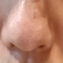비밀 | 비밀랩모공비밀 내돈내산 후기, 모공에센스 꾸준히 써본 솔직 리뷰