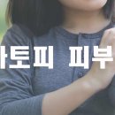 아토피 피부염, 근본원인 규명 이미지