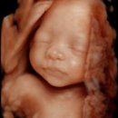 11650-17-30-12 | 임신일기 | 임신 황금기19주 - 30주 증상과 정밀초음파, 임당검사 후기부터 만삭촬영까지