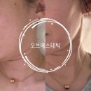 오브허밍 | 동탄예신관리 오브에스테틱 이중턱관리 주차 위치 관리후기
