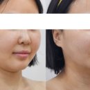 물오른피부 네이버블로그