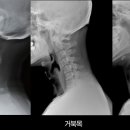 가온체형교정운동센터 이미지