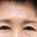 리미트성형외과의원