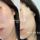 수원시 팔달구 중부대로106번길 | 아주대에스테틱 [더라르떼 수원인계점] 인계동 피부관리, 스킨 일렉트로닝 후기